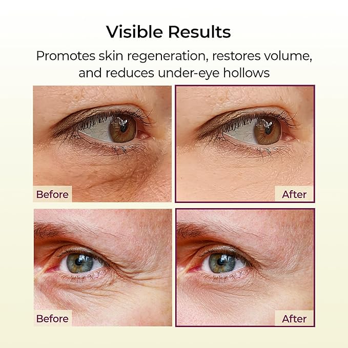 Dr.Melaxin Cemenrete Calcium Multi Balm 9g Korean Skin Care All In One Calcium Volume Stick Collagen Wrinkles Face Eye treatment Balm