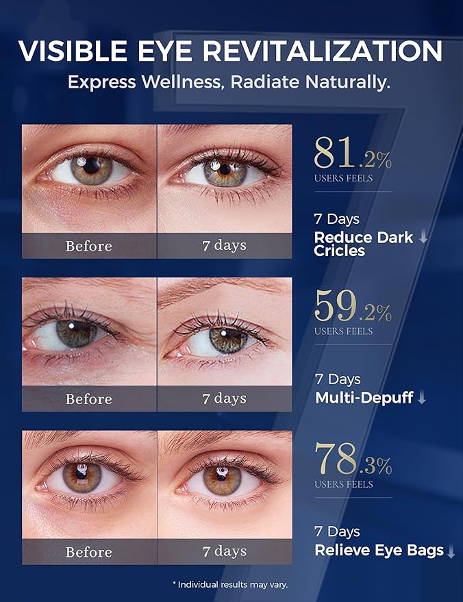 Retinol Eye Cream for Dark Circles with Caffeine Peptides Niacinamide Tranexamic Acid, Under Eye Cream for Puffiness and Eye Bags, Hydrating Firming Korean Eye Care 1.06 oz Silver