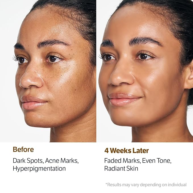 SUNGBOON EDITOR Kojic Turmeric Capsule Brightening Cleanser for Uneven Spots, Acne-prone Skin & Blackhead | Low pH Gentle Gel Face Wash | Kojic Acid & Niacinamide | Korean Skincare